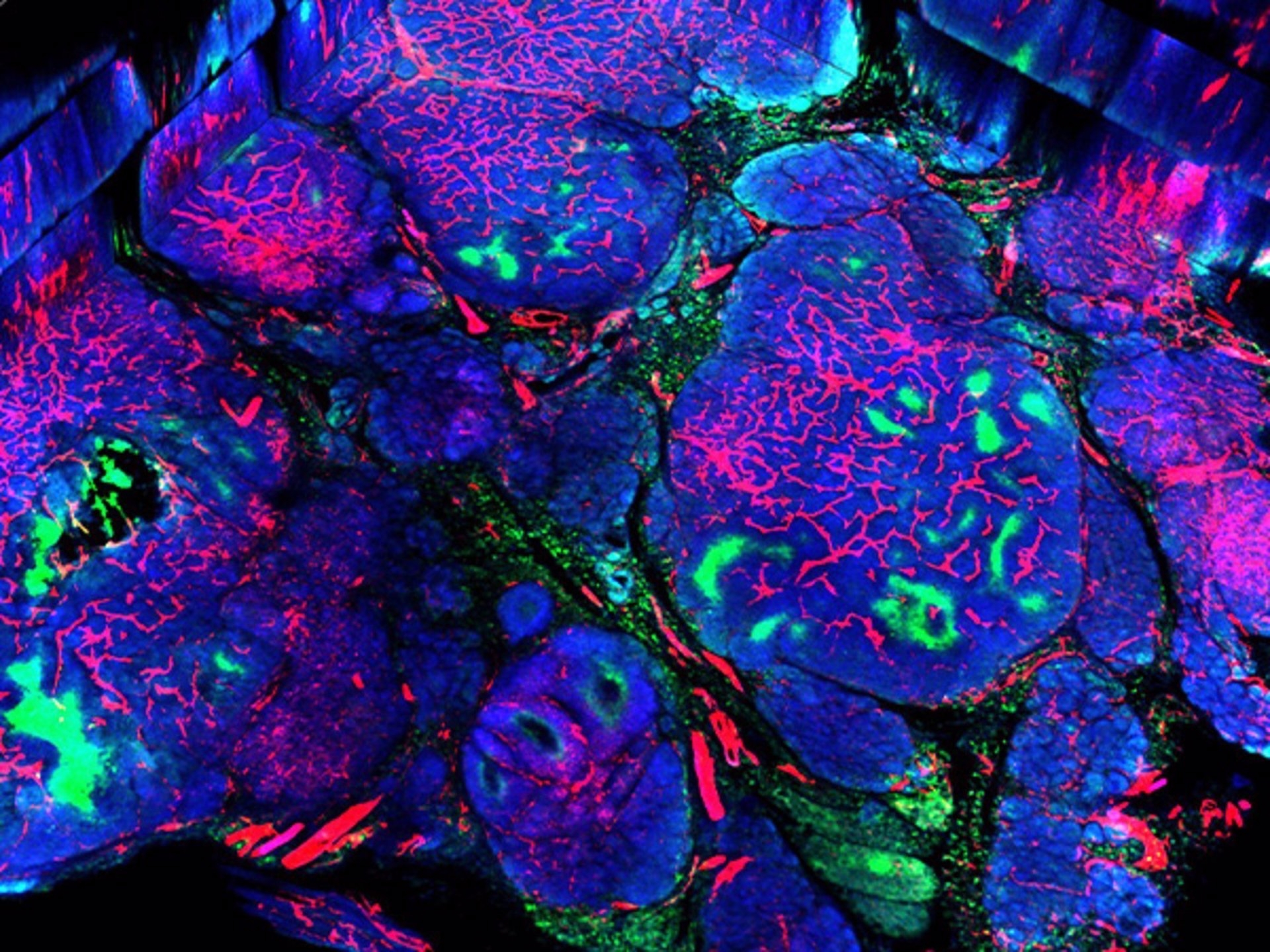 Identificada una nueva diana para el tratamiento de cáncer de mama
