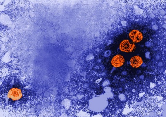 Un informe destaca la baja incidencia de hepatitis A y salmonelosis en Europa
