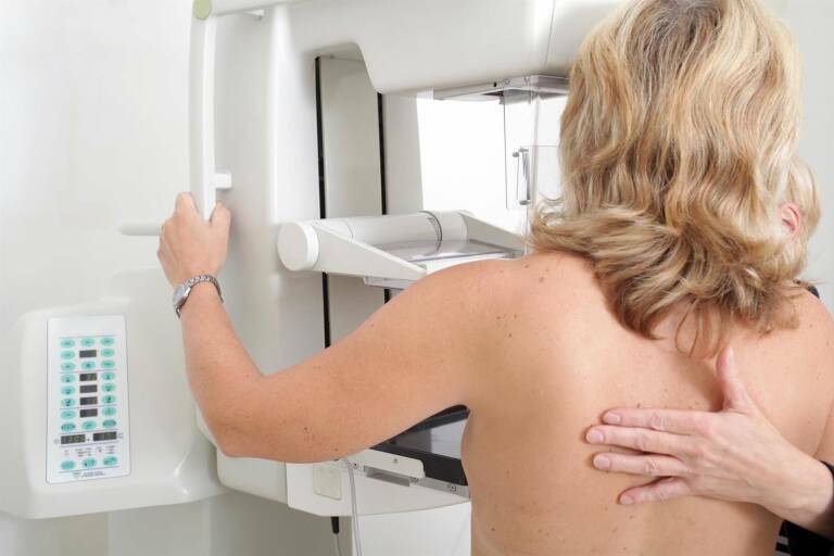 El ejercicio físico puede hacer que la radioterapia sea más tolerable para las pacientes con cáncer de mama