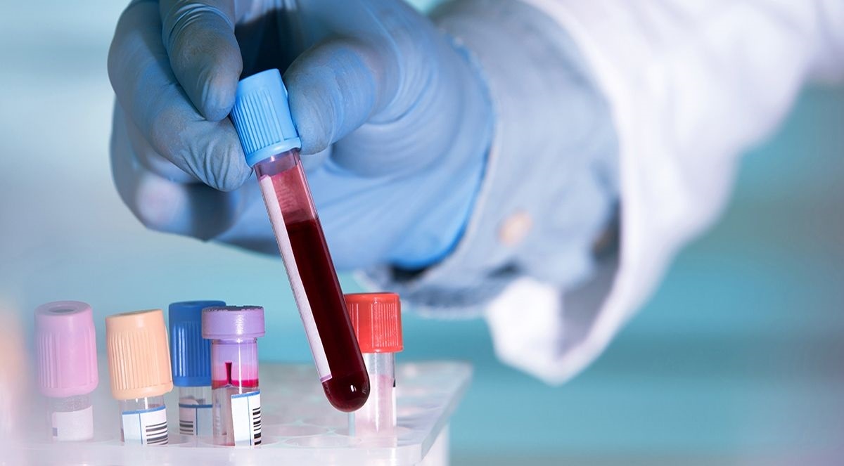 Castellón realizó un total de 61.695 pruebas para la detección del VIH en 2021