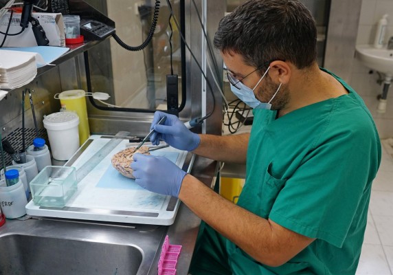 El Banco de Cerebros de la Arrixaca suma 280 donaciones desde su creación en 2007