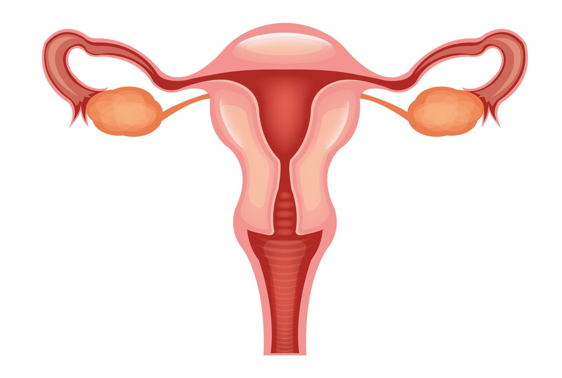 Qué es la Conización Cervical y por qué se realiza