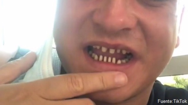Los dentistas advierten de los riesgos de viajar a Turquía para someterse a un tratamiento dental 'low cost'
