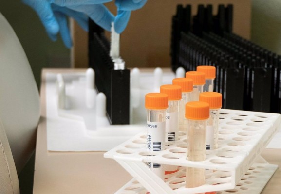 La Comunitat confirma dos nuevos positivos de viruela del mono y el total asciende a 432