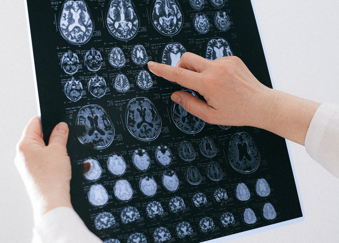 Foto: Anna Shvets/PEXELS - 