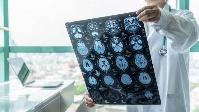 Investigadores descubren cómo la exposición al pesticida DDT incrementa el riesgo de Alzheimer
