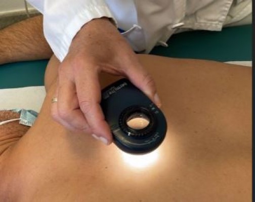 Salud recomienda la autoexploración de lunares para detectar precozmente el cáncer de piel
