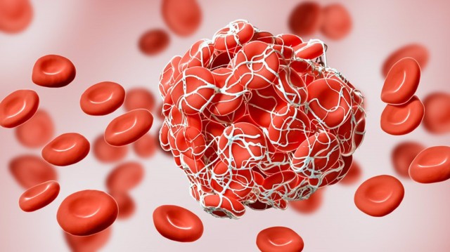 Identifican una proteína asociada con alto riesgo de formación de coágulos en pacientes con covid