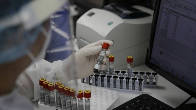 La Comunitat confirma 21 nuevos casos de viruela del mono, que elevan a 162 los positivos