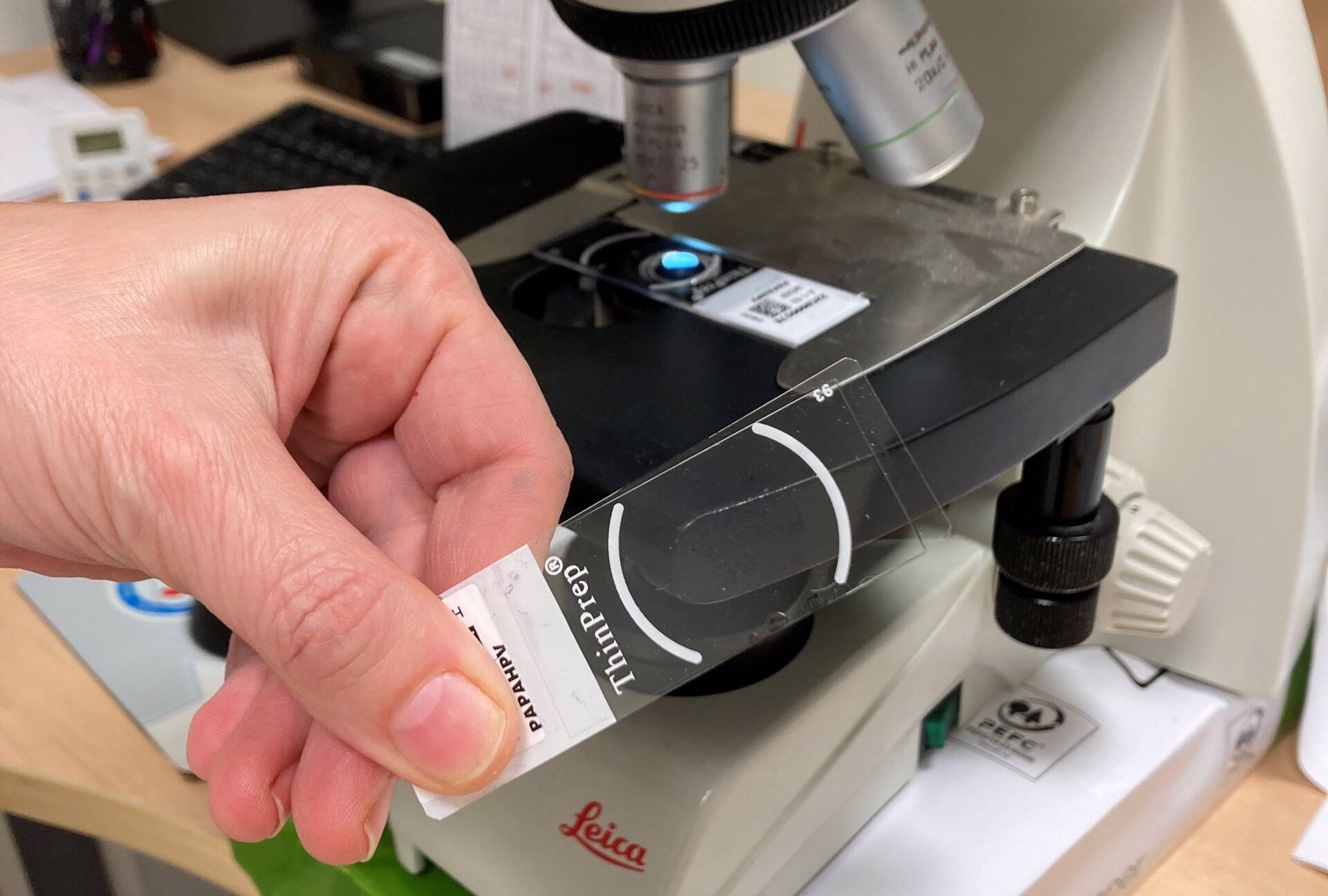 Pruebas para el cribado de detección precoz del cáncer de mama (archivo). Foto: GVA SANIDAD - 