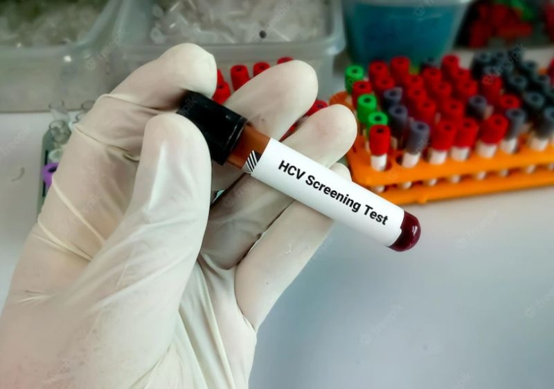 Expertos destacan las estrategias de cribado oportunista para facilitar el objetivo de eliminación de la hepatitis C en España
