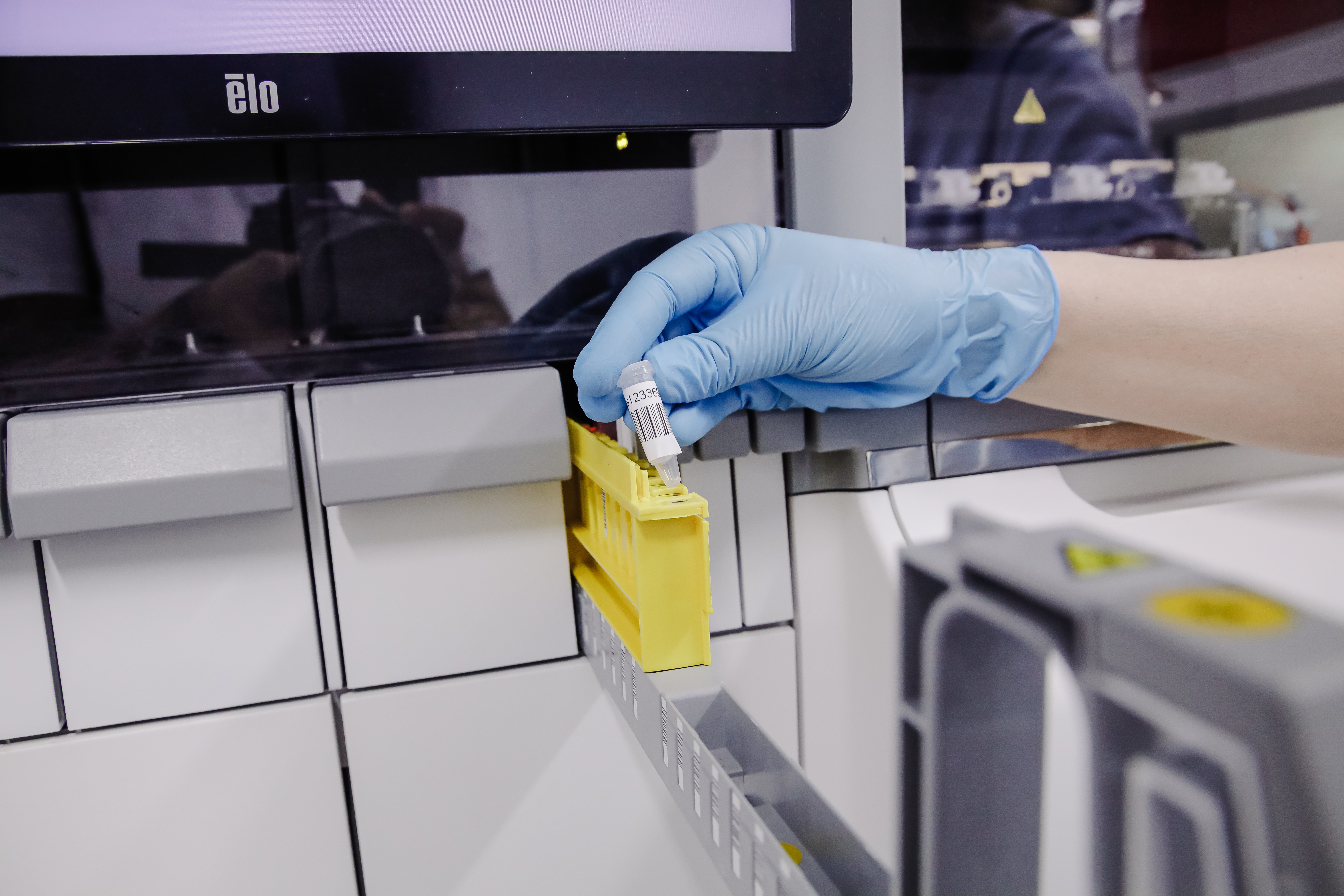 Los casos de viruela del mono se elevan a 37 en la Comunitat Valenciana tras confirmarse 6 nuevos