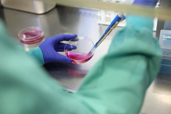 El Ministerio de Sanidad confirma 120 casos de viruela del mono en España
