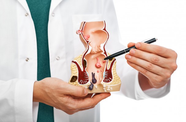Qué es la coloproctología: patologías que trata