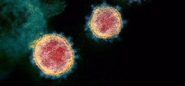 Un estudio analiza cómo efectos del coronavirus en el cerebro  pueden producir covid persistente
