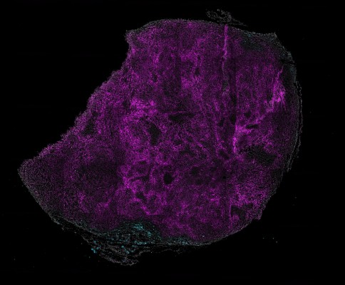 Una investigadora valenciana desarrolla una técnica innovadora para avanzar en la lucha contra el cáncer