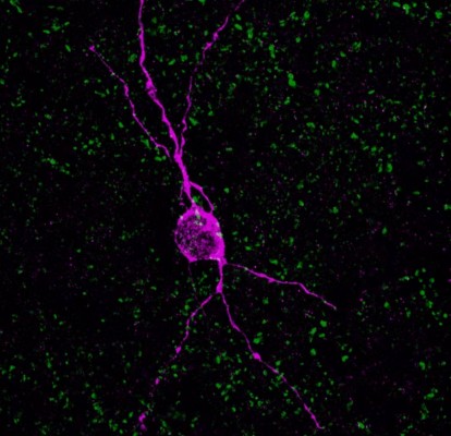 Investigadores descubren que existen neuronas jóvenes en la corteza cerebral de humanos adultos