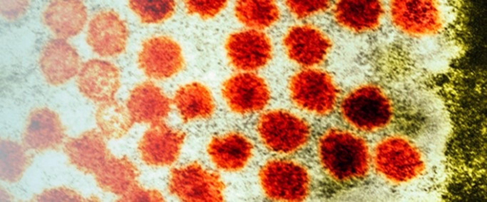 Sanidad pide a las CCAA que busquen activamente casos de hepatitis de origen desconocido en niños