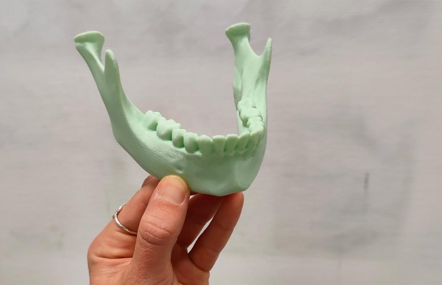 Aimplas desarrolla modelos anatómicos realistas para adaptar los procesos quirúrgicos a cada paciente