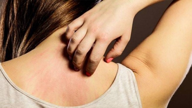 La ciencia lo confirma: a más calor, alergias más intensas