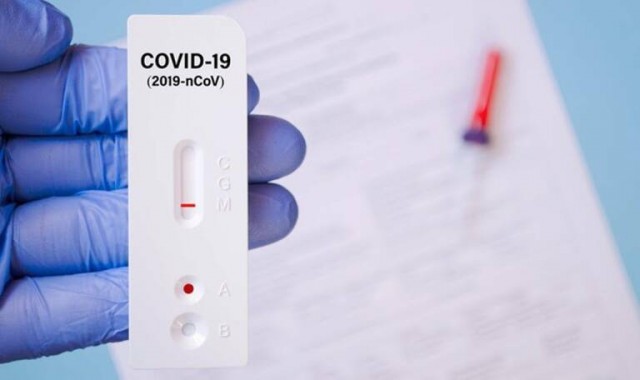 Cuatro fallecidos por covid en la Región mientras la sexta ola va a menos
