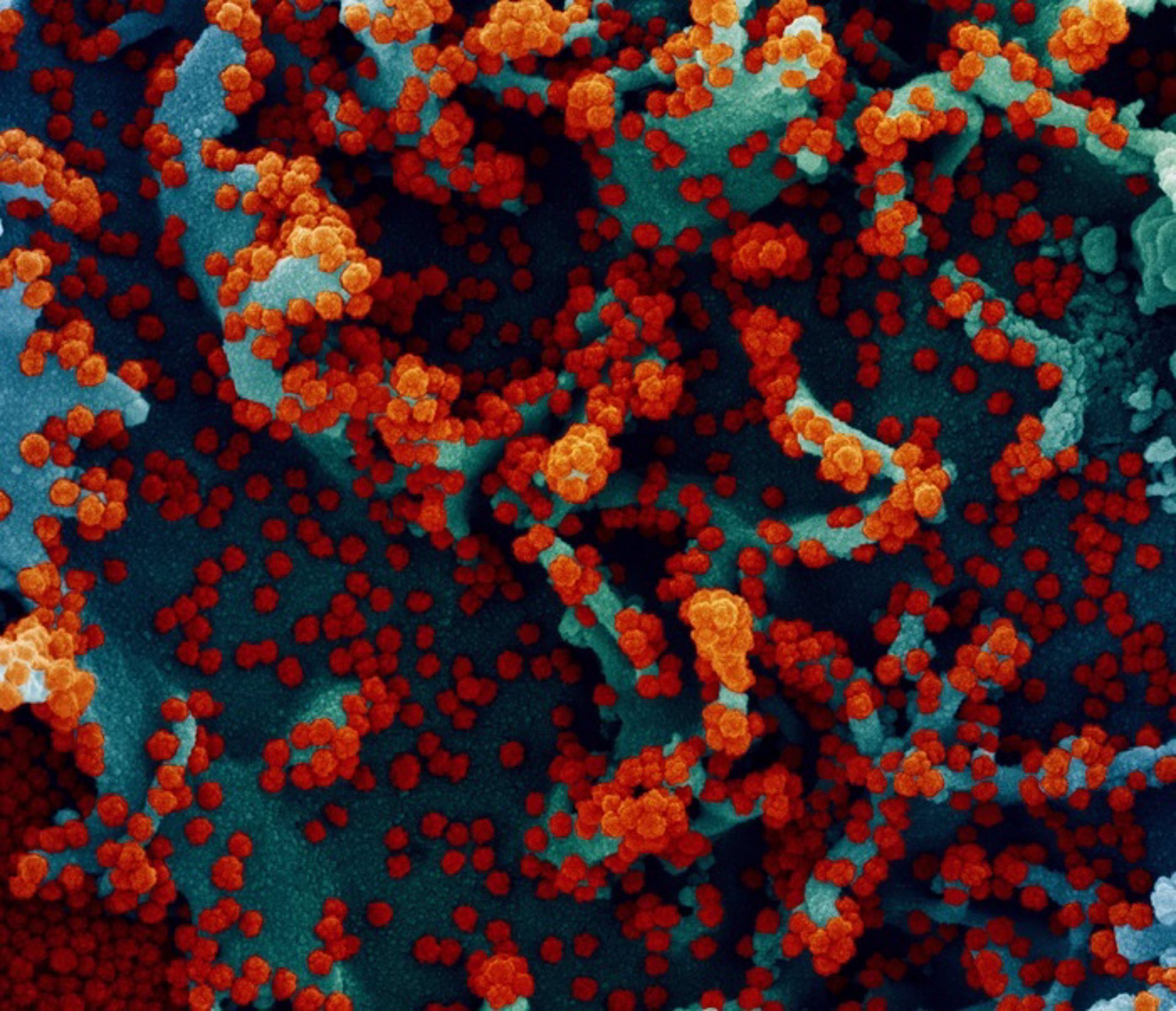 Un estudio apunta que las células pueden 'mutar' el coronavirus para hacerlo menos dañino
