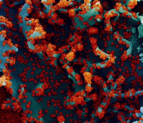 Un estudio apunta que las células pueden 'mutar' el coronavirus para hacerlo menos dañino
