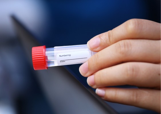 Científicos de la UMU desarrollan un método para detectar casos severos de covid a través de la saliva