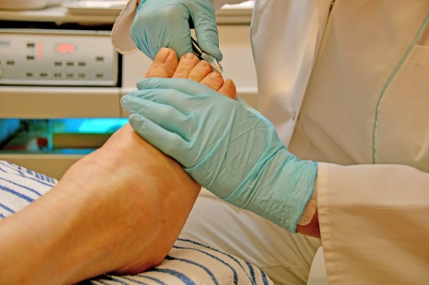 Los podólogos advierten de que algunos tratamientos oncológicos pueden provocar lesiones en los pies de los pacientes