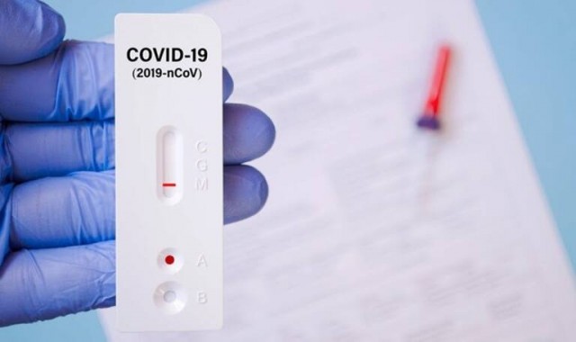 Los viajeros que entren a España con test rápido de antígenos deben hacérselo en un plazo anterior de 24 horas