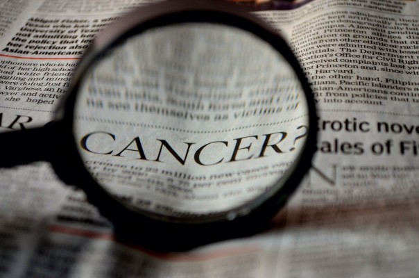 Un estudio muestra que el cáncer de próstata temprano puede albergar células tumorales agresivas
