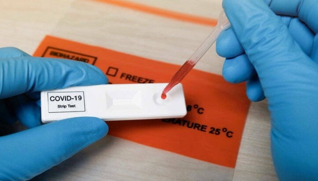 Sanidad ha repartido más de seis millones de test de antígenos de uso profesional a las CCAA