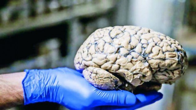 El Instituto de Neurociencias UMH-CSIC descubre la molécula que regula el tamaño del cerebro 