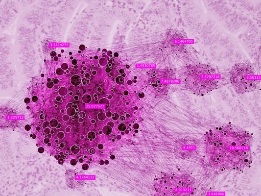 Un fármaco de inmunoterapia resulta prometedor en el cáncer de endometrio avanzado
