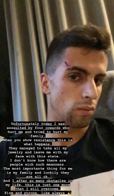 Joao Cancelo es agredido tras un asalto a su domicilio