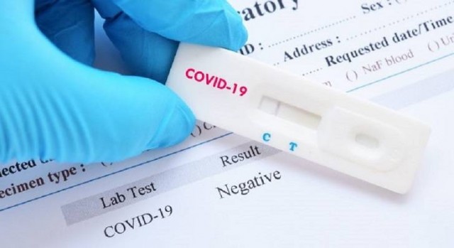La venta de test se disparó para la Navidad: casi 272.000 más que la semana anterior