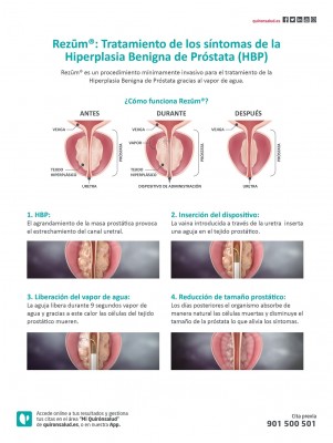 ¿Qué es la técnica Rezum?
