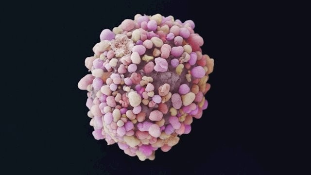 La Comisión Europea autoriza la comercialización de sacituzumab govitecán para tratar el cáncer de mama triple negativo metastásico en segunda línea
