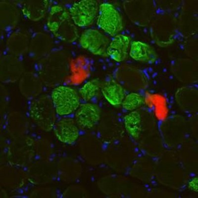 Un nuevo estudio describe un nuevo mecanismo para la regeneración muscular después de un daño fisiológico 