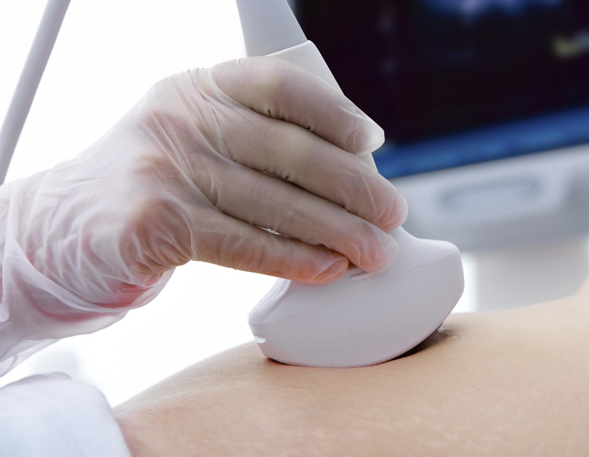 La Comunitat Valenciana llevó a cabo 7.510 abortos voluntarios durante el 2020
