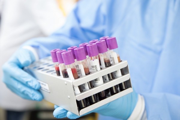La Región cuenta ya con más de 24.700 donantes potenciales de médula ósea