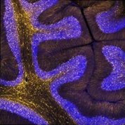 Los genes humanos que más rápido evolucionan están vinculados a cambios evolutivos en el desarrollo del cerebro
