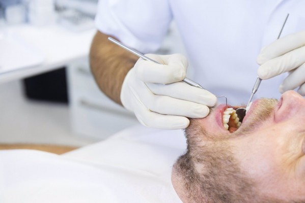 La bacterias bucales son la principal causa de periodontitis, una de las principales causas de la pérdida de dientes
