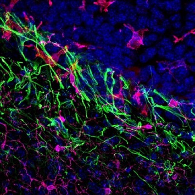 Investigadores del CSIC estudian los mecanismos fundamentales de la metástasis