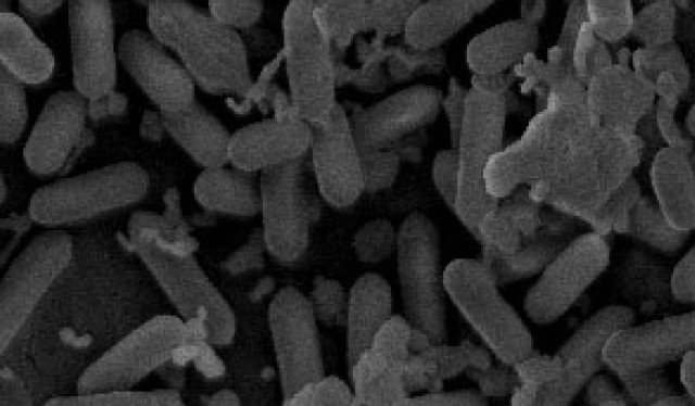 Cataluña notifica la presencia de listeria en varios lotes de botifarra enviados a la Comunitat