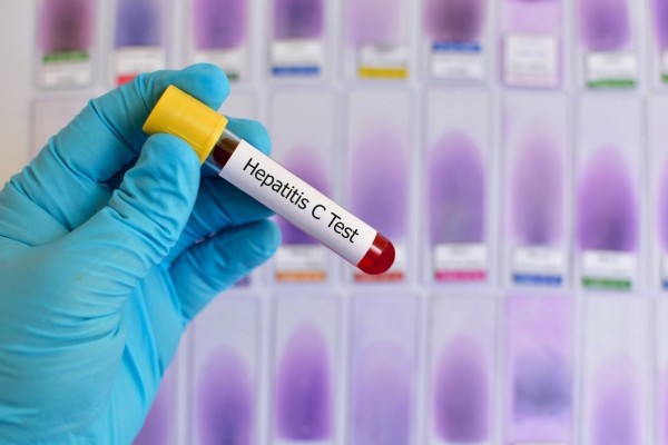 Los nuevos tratamientos antivirales de acción directa pueden curar más del 95% de casos de hepatitis C
