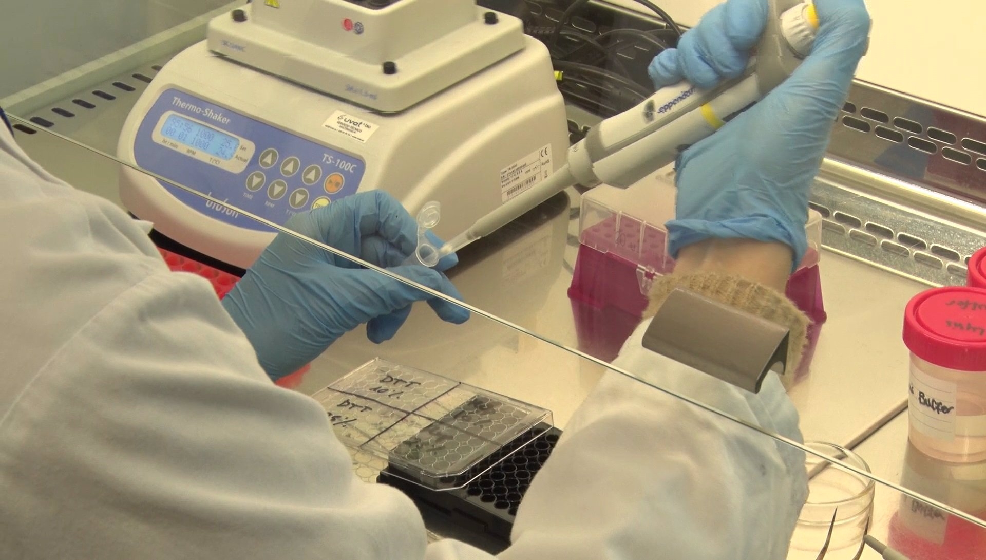 Nuevo test de detección de la covid. Foto: UPV - Archivo - 