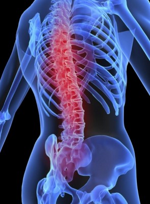 Silicona para las fracturas de columna