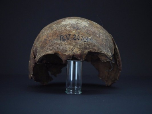 Encuentran la cepa de peste más antigua en un hombre de hace 5.000 años
