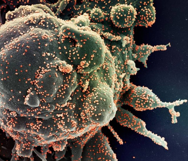 Un nuevo test del CSIC logra detectar anticuerpos al virus que hasta ahora eran invisibles
